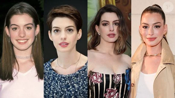 Anne Hathaway antes e depois de possíveis tratamentos estéticos