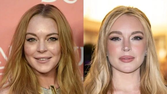 Lindsay Lohan antes e depois